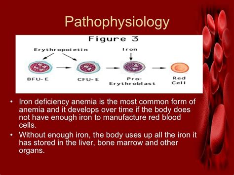 Iron Deficiency Anemia