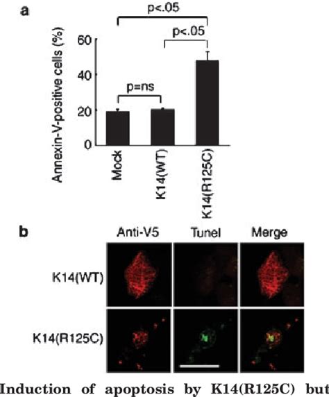 Figure 2 From An Autocrine Paracrine Loop Linking Keratin 14 Aggregates