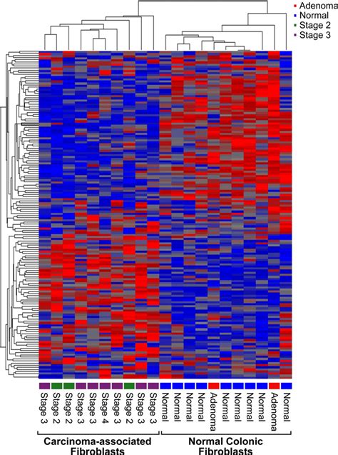 Heat Map Showing Differential Gene Expression Of Colorectal Derived Download Scientific Diagram