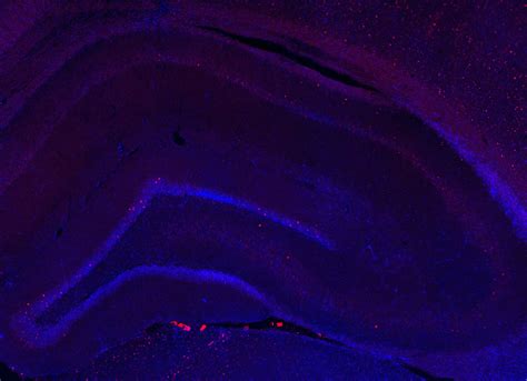 What’s all the Fos about? (staining protocol)