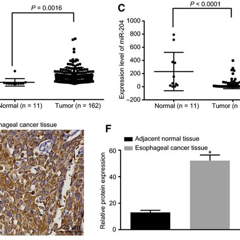 Microrna Mir Has Low Expression Level While Hotair And Hoxc