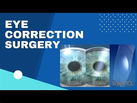 Parkhurst Nuvision Lasik Advanced Vision Correction Choices Lasik