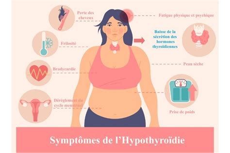 Lhypothyroïdie Que Faire