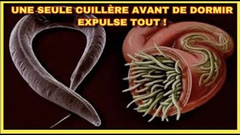 débarasseZ LE COLON définitivement des PARASITES OXYURES ET VERS