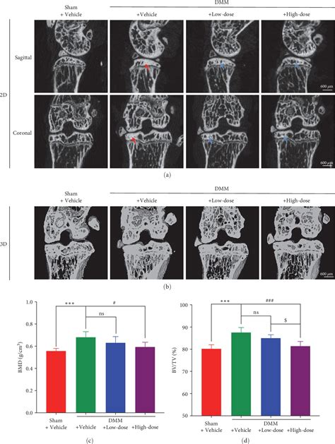 Figure 1 From Betulinic Acid Attenuates Osteoarthritis Via Limiting