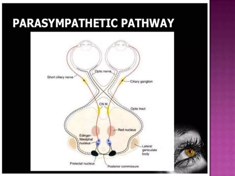 Anisocoria | PPT