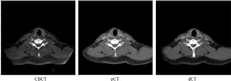 Cancers Free Full Text Cbct To Ct Translation Using Registration