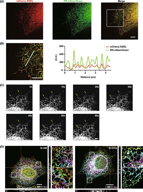 A Novel Fluorescent Endoplasmic Reticulum Marker For Superresolution