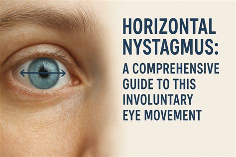 torsional nystagmus  clear definition