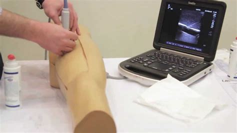 Ultrasound Guided Femoral Arterial Access YouTube