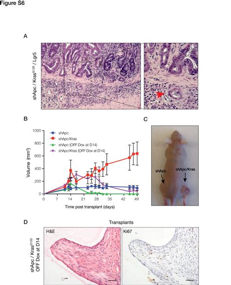 Apc Restoration Promotes Cellular Differentiation And Reestablishes