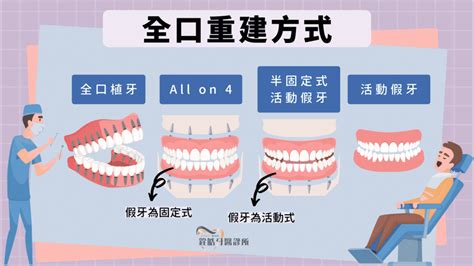 全口重建費用要多少？預算、優劣、療程全告訴你！