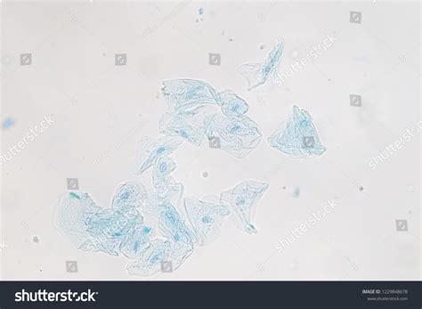 Characteristics Squamous Epithelial Cell Cell Structure Stock Photo ...