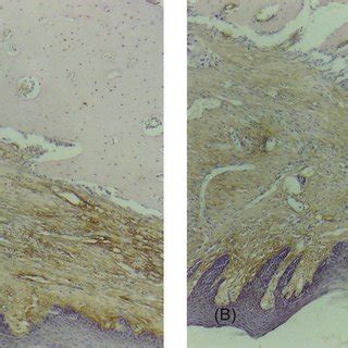 Immunohistochemical Staining Of Collagen Type I In Day Old Wounds