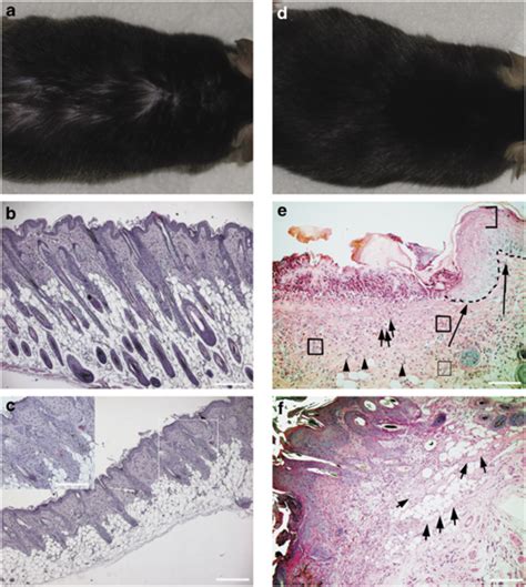 Development Of Skin Phenotype In Tcl1 Mice A Alopecia In The Skin Download Scientific