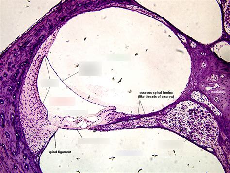 Biol Labex Cochlea Slide Diagram Quizlet