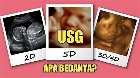 Lihatlah Perbedaan Usg 2d 3d 4d Update