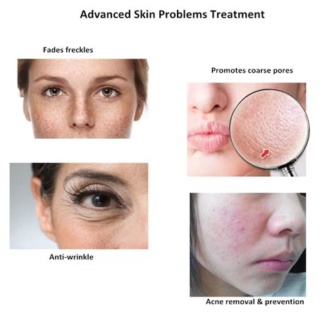 spongilla spicule freshwater hydrolyzed sponge skin conditioning