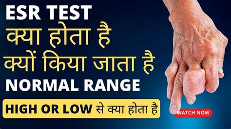 Esr Test Kya Hota Hai Esr Badhne Se Kya Hota Hai Esr Test Hindi