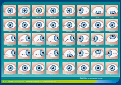 Sclera Signs Chart