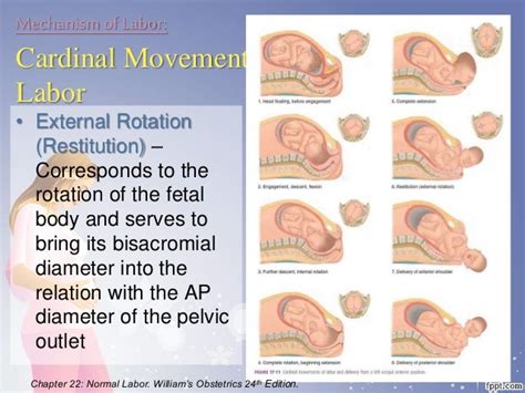 Normal Labor And Delivery