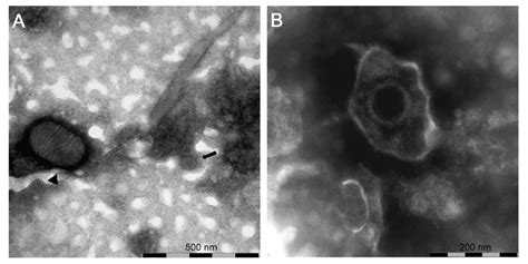 Negative-staining electron microscopy of: (A) sample (#7) showing the... | Download Scientific ...