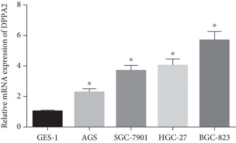 Ctcfl And Dppa2 Are Highly Expressed In Gastric Cancer Tissue And