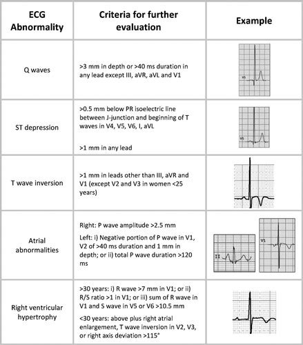 Interpretation Of The Electrocardiogram Of Young Athletes Circulation