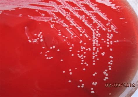 Colonies On Blood Agar Download Scientific Diagram