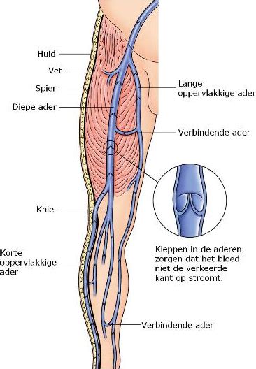 Operaties Voor Spataders Vasculaire Heelkunde Heelkunde Urologie