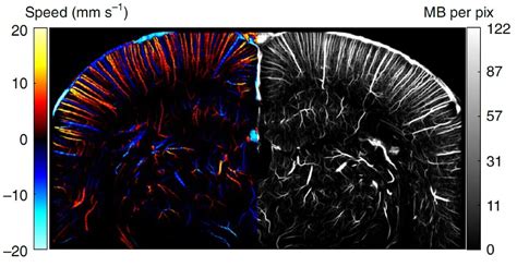 Ultrasound Technique Captures Micron-scale Images Of Brain Activity - Plato Data Intelligence