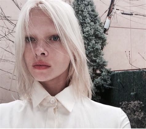 “Different” Beauty: Albino Models Who Are Changing The Fashion World ...