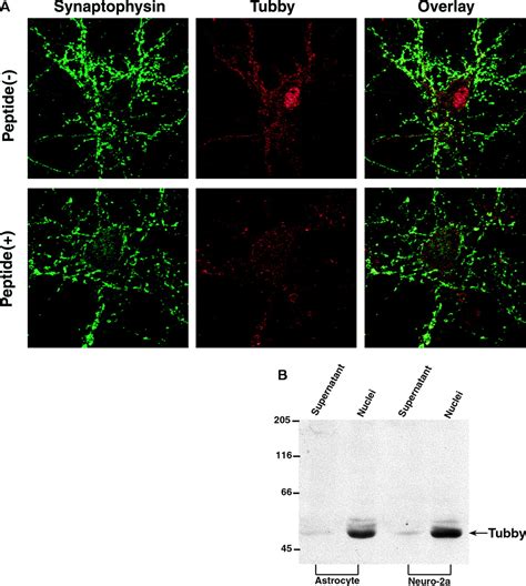 Implication Of Tubby Proteins As Transcription Factors By Structure