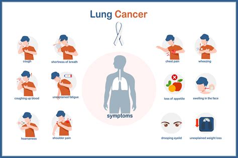 Vector medical illustration of lung cancer symptoms in flat style.Human lungs and males in ...