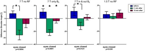 Results Of The Unterberger S Stepping Test Of Phase Displaying Body