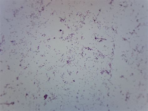 Candida Albicans Microscope Slide