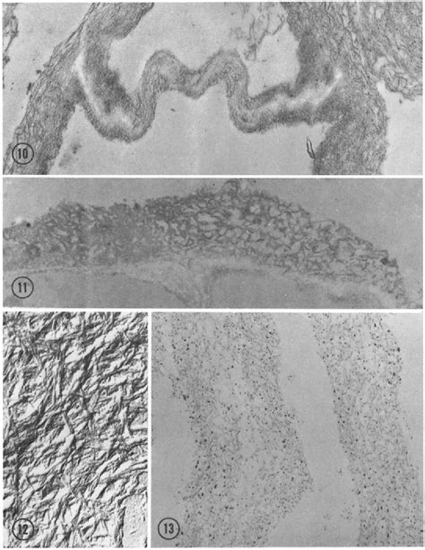 Pdf Localization Of Structural Polymers In The Cell Wall Of