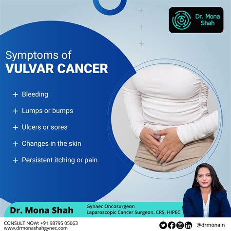 Vulvar cancer is a rare disease in which malignant (cancer) cells form