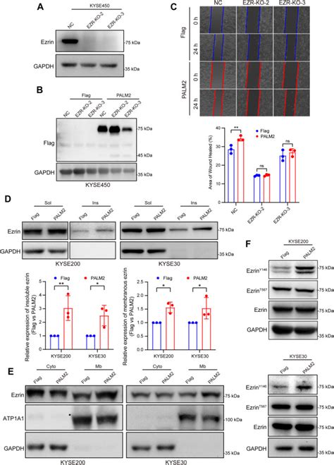 Prenylated Palm Promotes The Migration Of Esophageal Squamous Cell