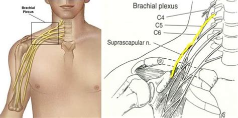 Suprascapular Neuropathy Boston Shoulder Institute