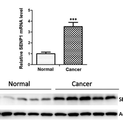 Small Ubiquitin Related Modifier Specific Protease Senp Is