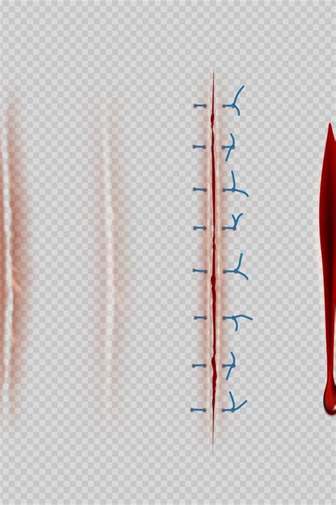 Surgical sutures. Medical closeup stitches scars and wounds