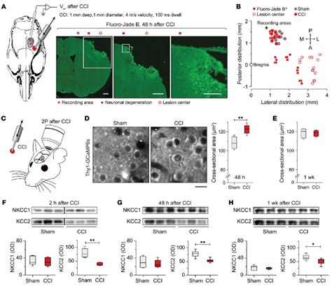 Neuronal Volume Measurements And CCC Expression In The Perilesional