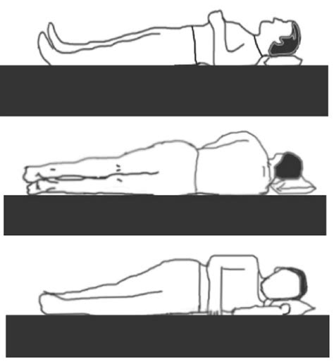 Sleeping Position Included Supine Right Lateral Decubitus Posture And