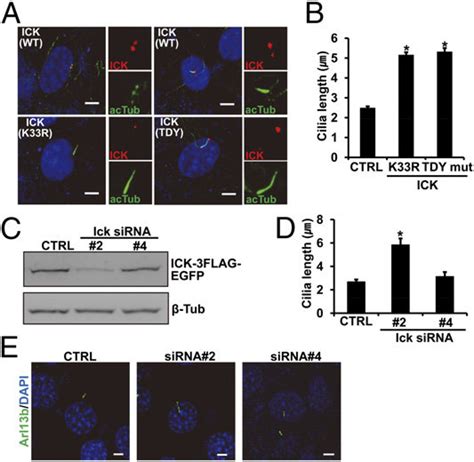 Ick Kinase Activity Levels Determine The Length Of Primary Cilia A Download Scientific