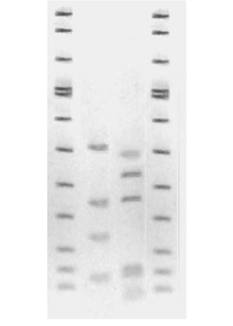 Rflp Profiles Generated With Alui Are Shown Digested S S Rdna