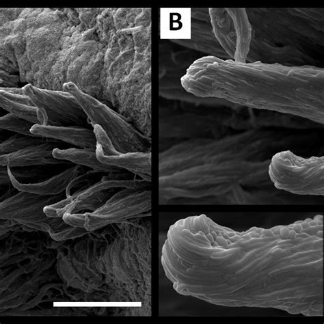 Electron Micrographs Of The C Tropicalis Rough Morphotype Following