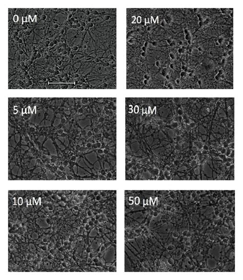 Effect Of Curcumin On Cerebellar Granule Neurons CGNs Viability In