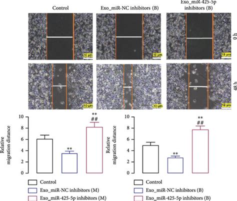 Bc Cell Derived Exosomes Induced Proliferation Invasion And Migration