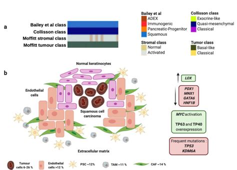 The Match Between Molecular Subtypes Histology And Microenvironment Of